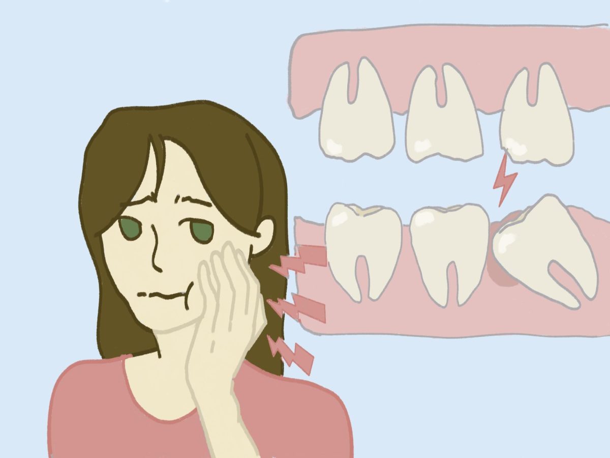 Many students have their wisdom teeth removed during high school to prevent dental problems down the road.
